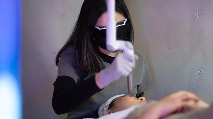 Fotona® Micro Laser Peel