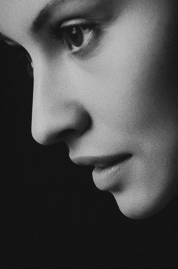 Non-Surgical Rhinoplasty