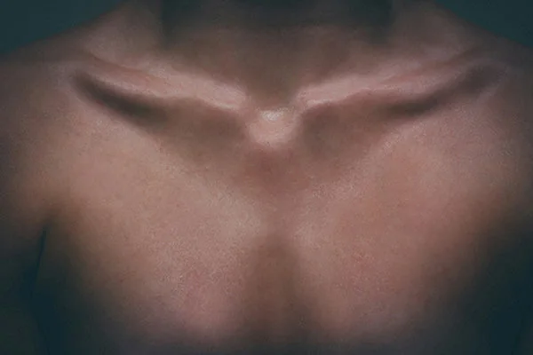 Aging Chest